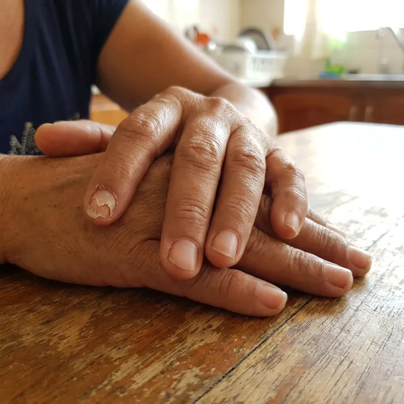 Primer plano de las manos de una mujer mostrando una uña rota y agrietada.